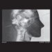 Zombi Direct Inject cover